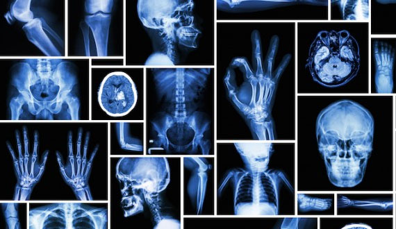 Imagerie médicale