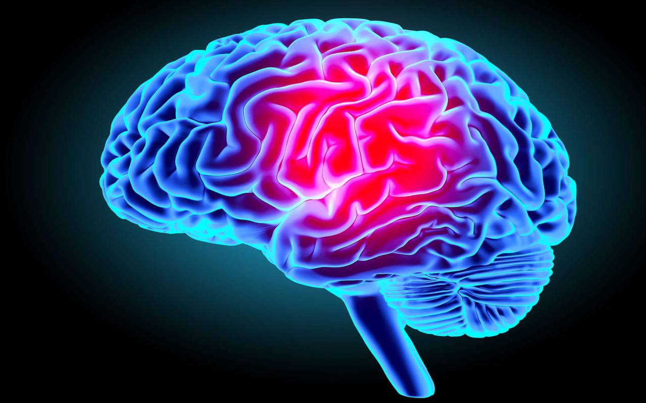 Neurologie