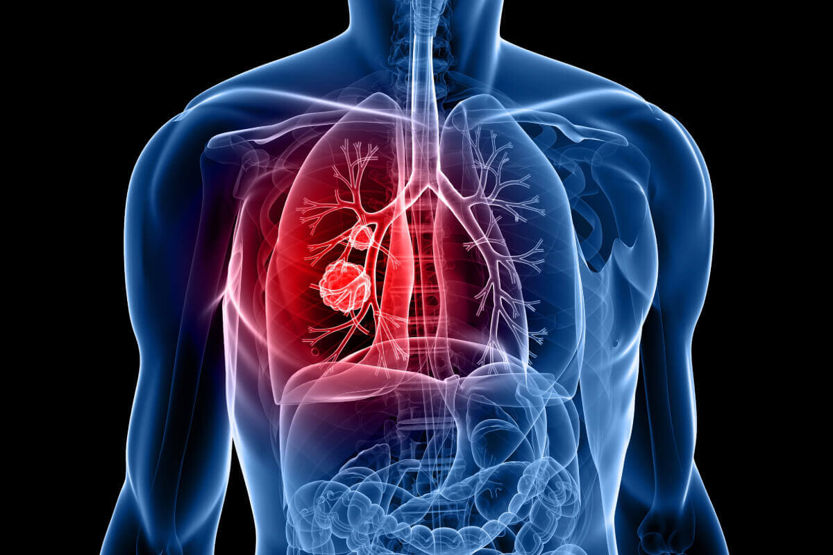 Pneumologie